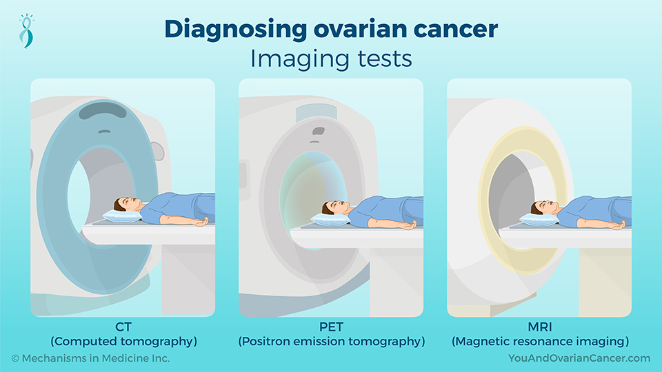 Diagnosing ovarian cancer - Imaging tests