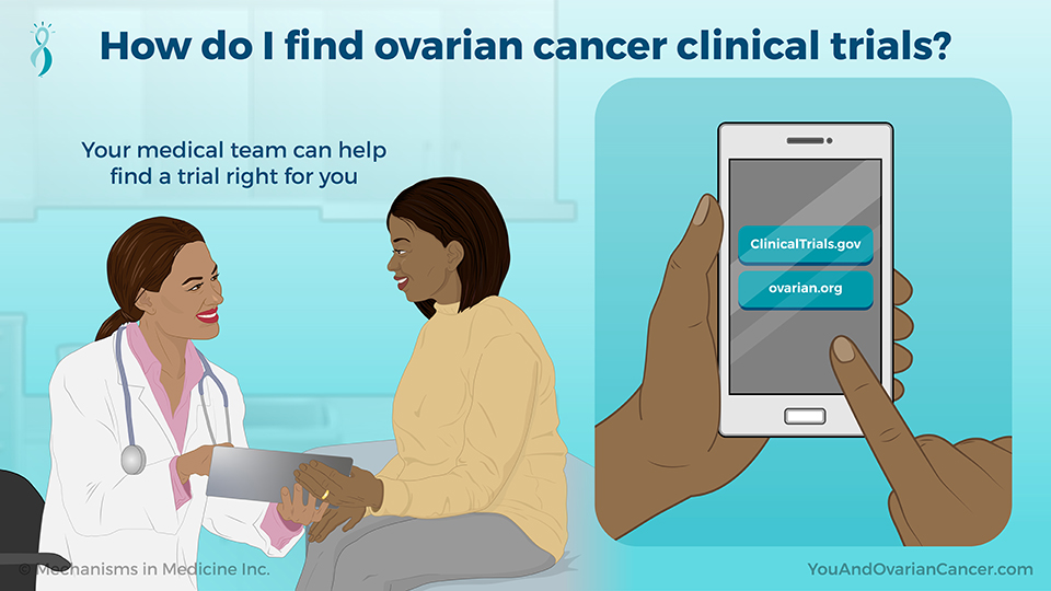 How do I find ovarian cancer clinical trials?