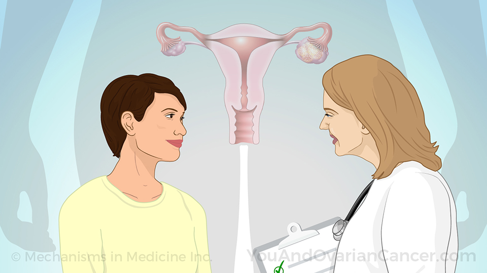 Animation - Understanding Ovarian Cancer