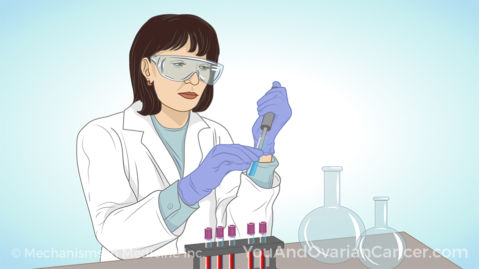 Animation - Understanding Clinical Trials in Ovarian Cancer