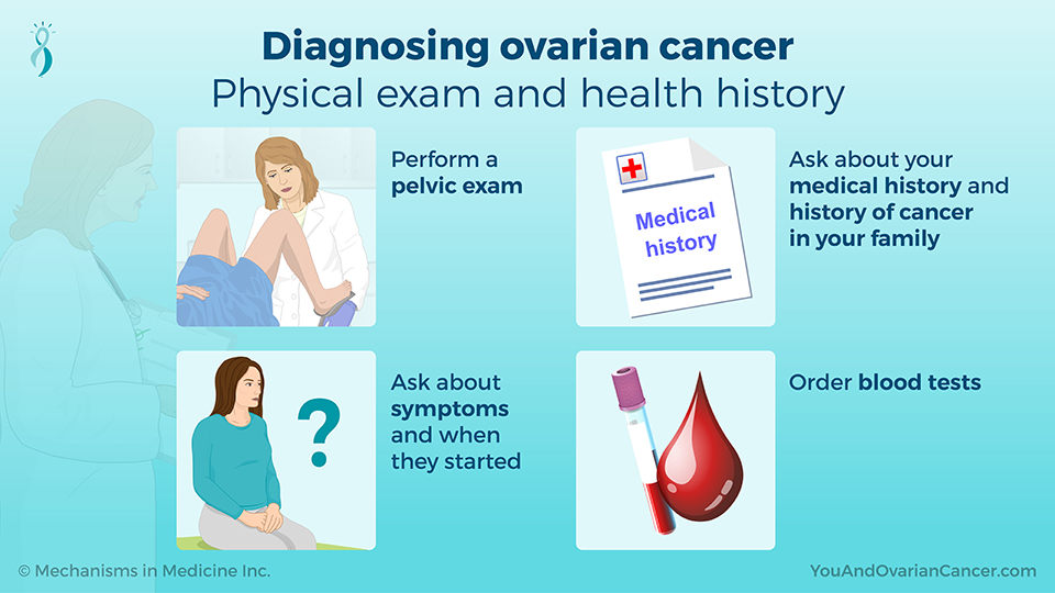 Diagnosing ovarian cancer - Physical exam and health history