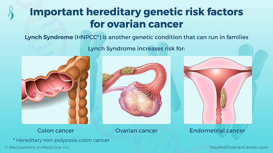 Important hereditary genetic risk factors for ovarian cancer