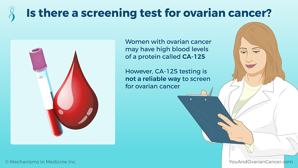 Is there a screening test for ovarian cancer?