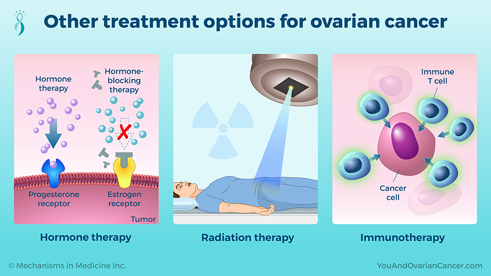 Other treatment options for ovarian cancer