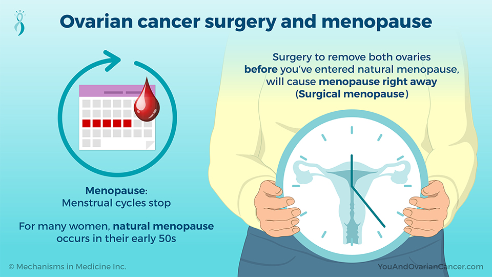 Ovarian cancer surgery and menopause