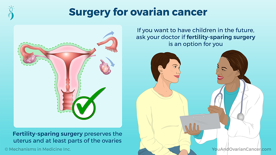 Surgery for ovarian cancer
