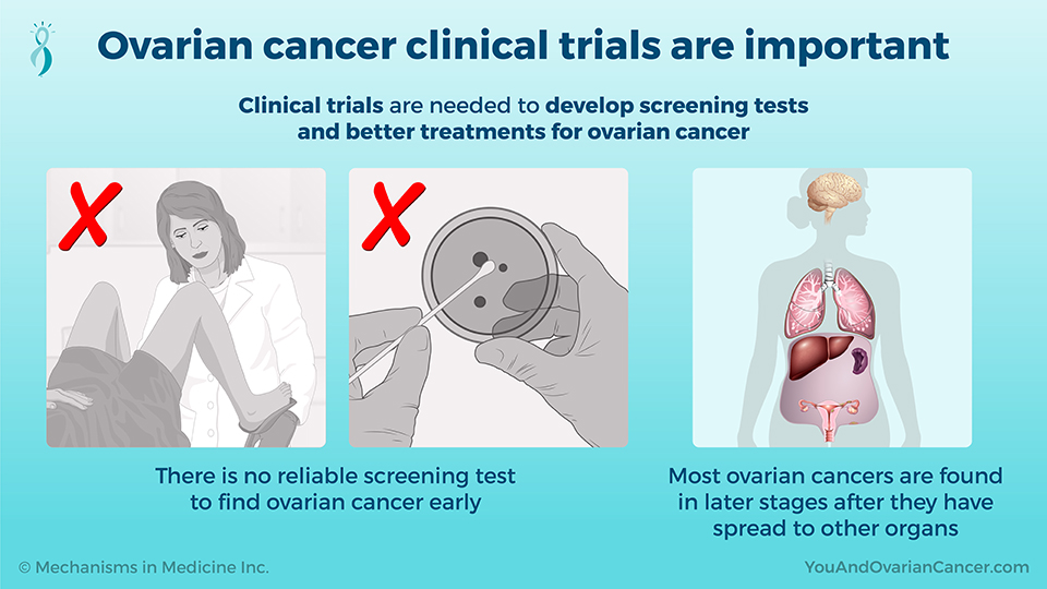 Ovarian cancer clinical trials are important 