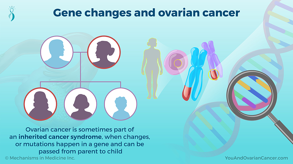 Gene changes and ovarian cancer