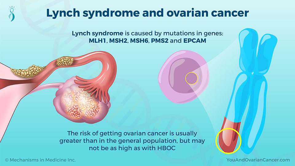 Lynch syndrome and ovarian cancer
