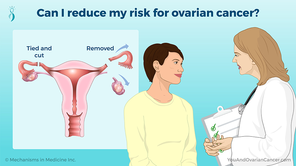 Can I reduce my risk for ovarian cancer?
