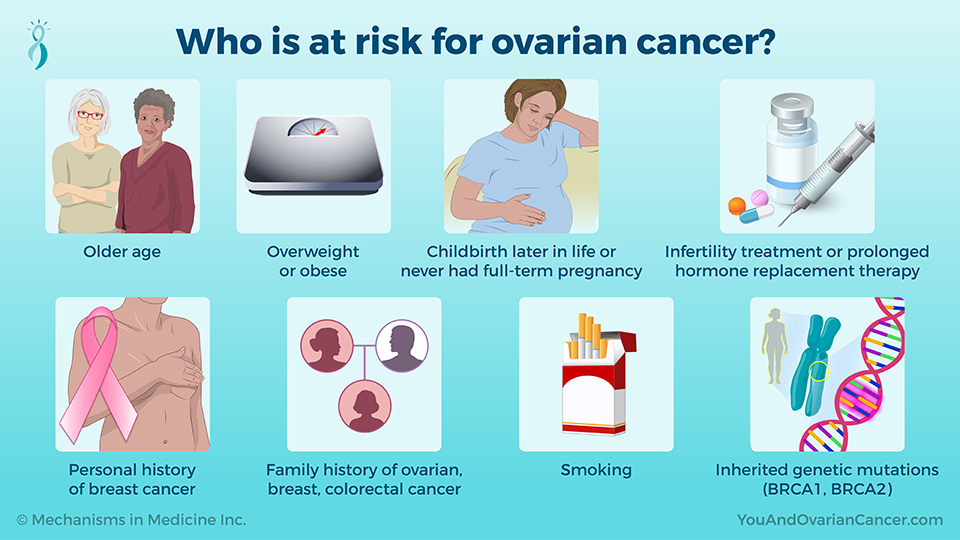 Who is at risk for ovarian cancer?